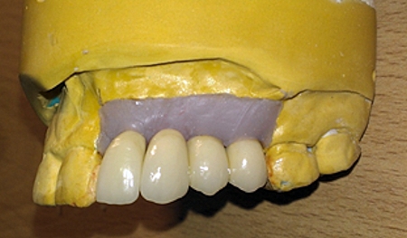 Finished job ready for fit